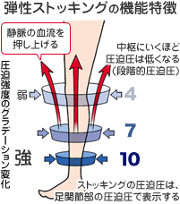 弾性ストッキングの圧迫強度のグラデーション変化