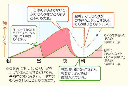 むくみの発生サイクル図